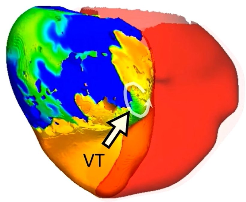 A roughly heart-shaped 3D structure in thermal colors, from red to blue. In the...