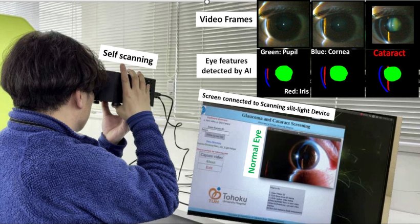 A man is holding the eyepiece of a diagnostic eye scanning system to his eyes....