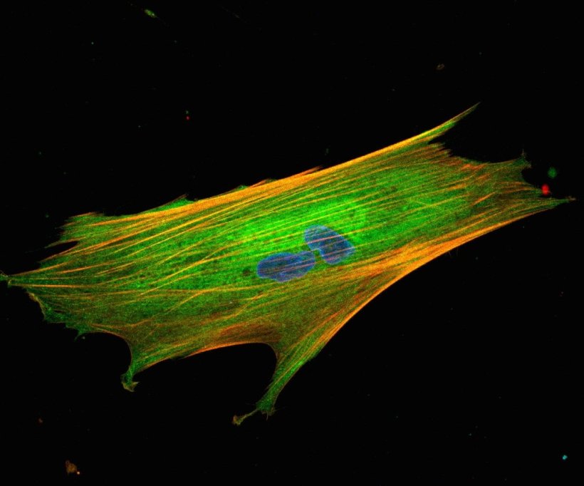 Fibroblasts of a cancer cell in blue, green and yellow, against a black...