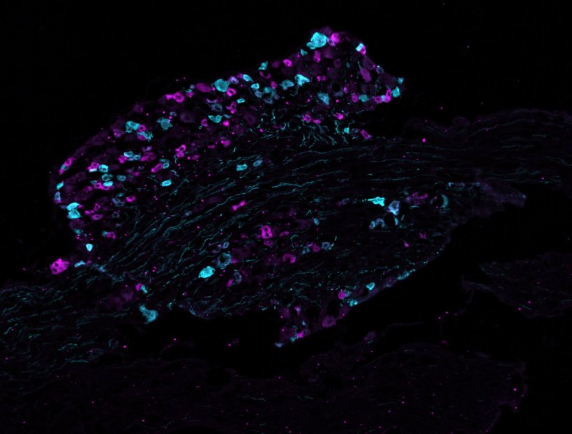 Ansammlung von Zellen, in Cyan und Megenta eingefärbt, vor einem schwarzen...