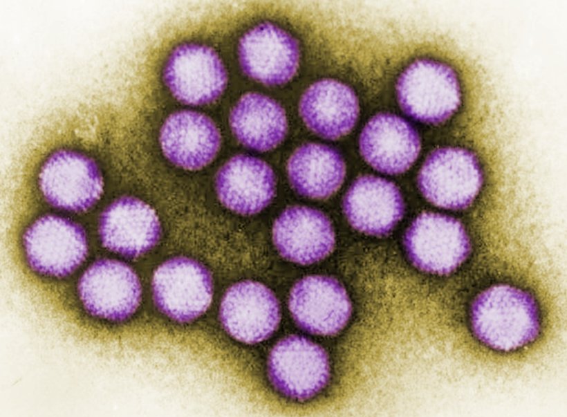 Adenovirus-Cluster unter dem Transmissions-Elektronenmikroskop, gefärbt in...