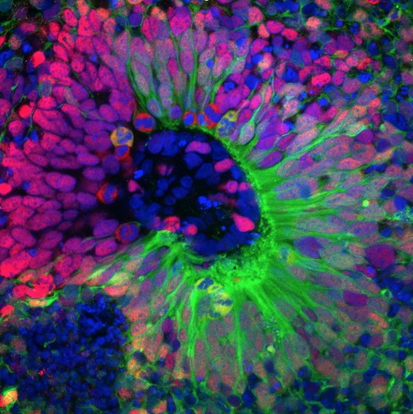 Multicolored image of a brain organoid