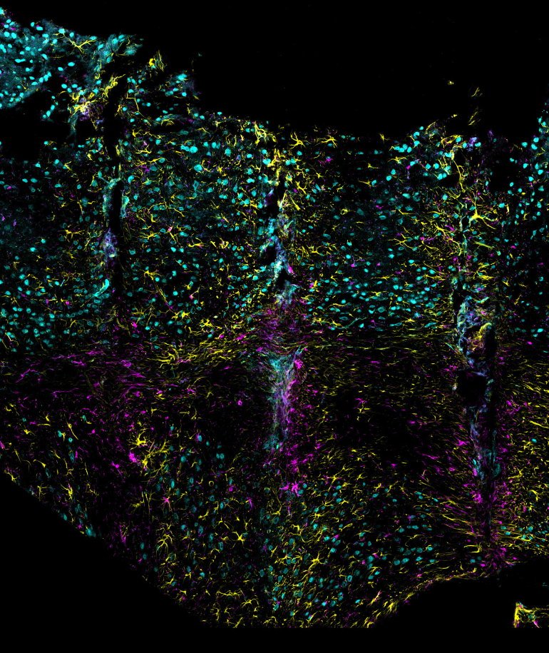 Filigrane yellow, cyan and magentr structures against a black background