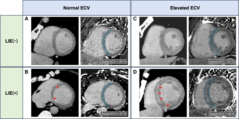 Four sets of cardiac CT scans, arranged in a grid according to their respective...