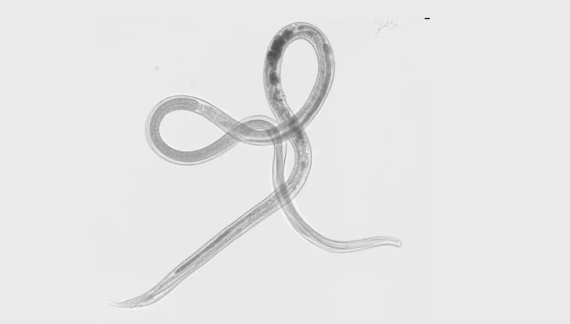 mikroskopische Aufnahme eines Parasiten