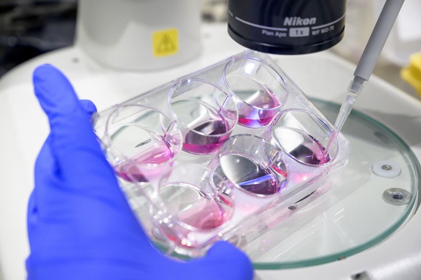 Ein Wissenschaftler entnimmt mit einer Pipette eine blassrosa Flüssigkeit aus...