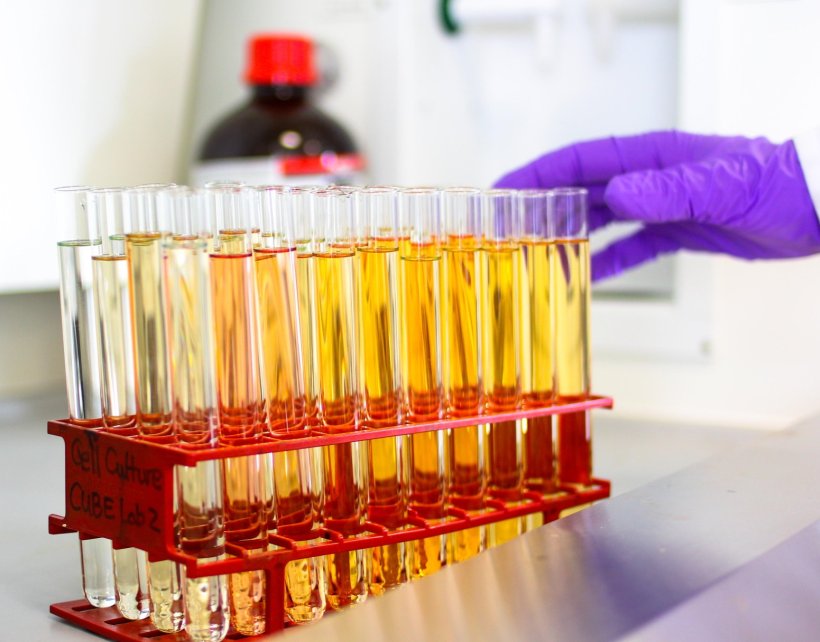 Urine samples in a red sample rack in a medical laboratory setting. From the...
