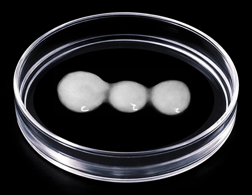 A petri dish on a black background, containing three semi-connected white...
