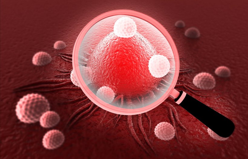 A magnifying glass is positioned over a red cancer cell, with smaller spiky...