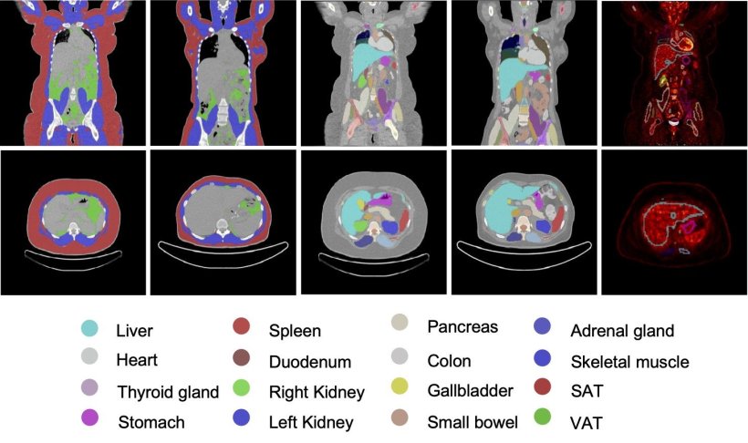 Representative whole-body PET/CT based organ and tissue segmentation before and...