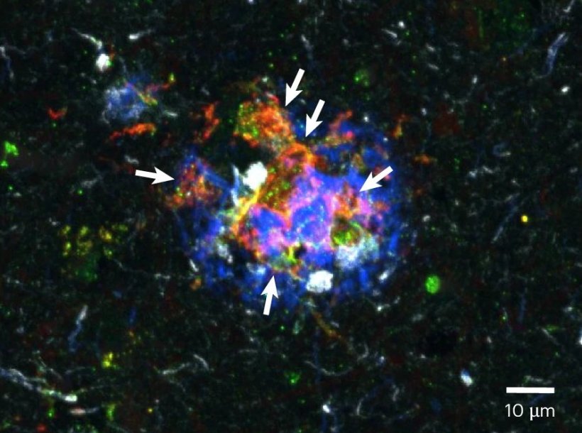 immunofluorescence image of microglia cells in the brain; the image looks like...