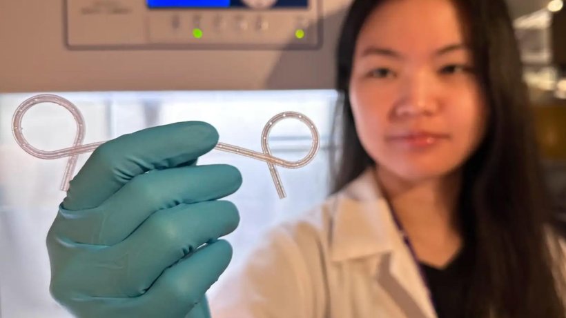Parima Phowarasoontorn holds an unusually-shaped stent
