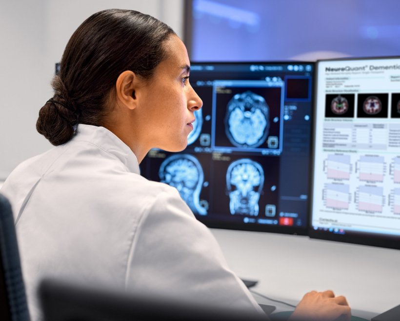 A clinician is viewing AI-enhanced neuroimaging analytics on multiple screens