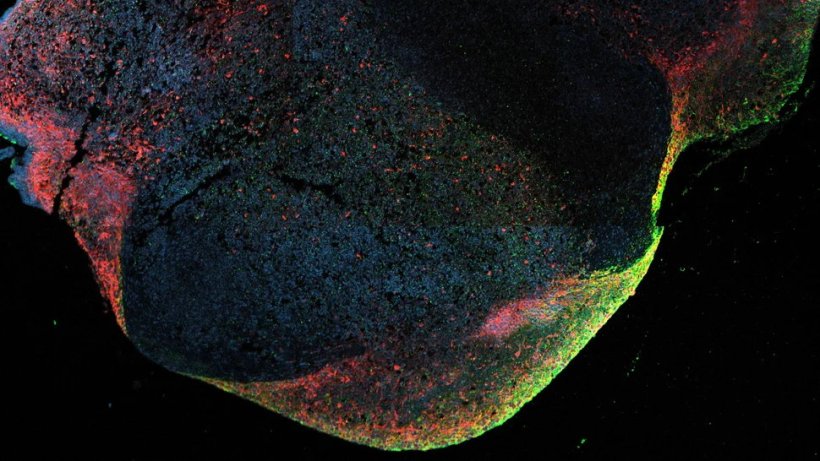 Das Foto zeigt eine Fluoreszenzaufnahme von einem Hirnorganoid, das mit dem...