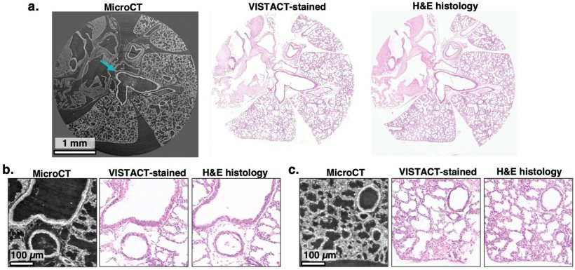 Virtuelle H&E-Färbung einer mittels Mikro-CT abgebildeten Lungen-/Herzprobe...