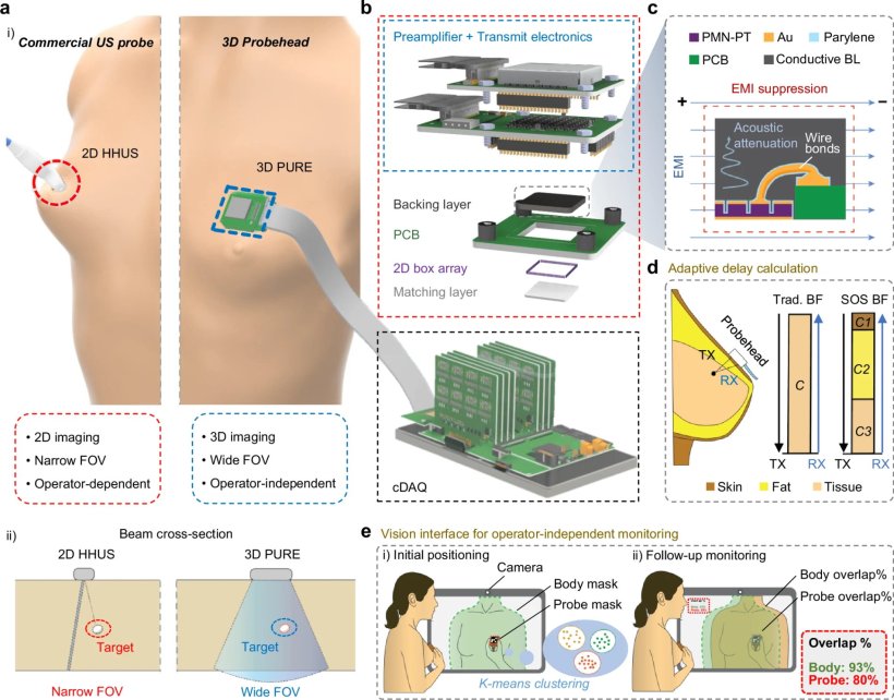 Overview of the 3D portable ultrasound for real-time examination for portable...