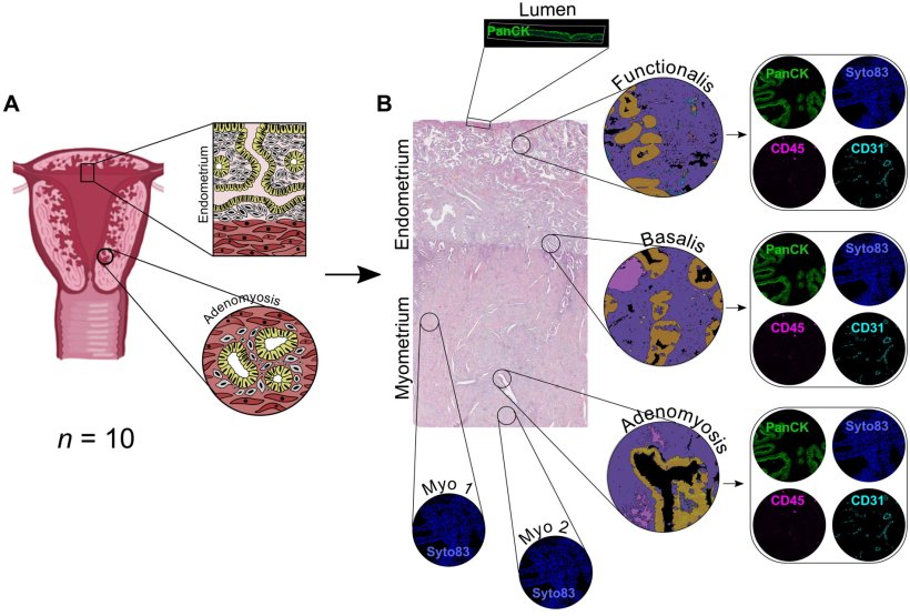 Endomyometrial regions and cell types analyzed. (A) Biopsies were obtained from...