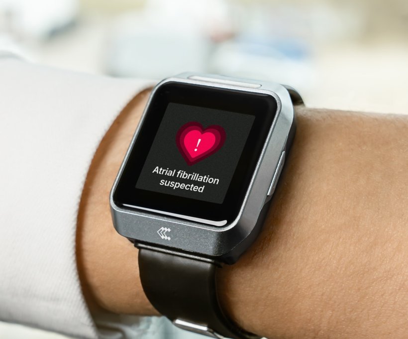 Closeup photo of a medical smartwatch on a persons arm. On the display, a heart...