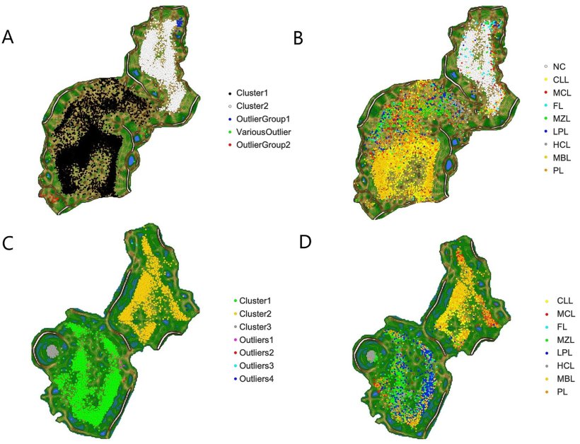 Topografische Karte des Lymphoms auf der Grundlage des neuen KI-Modells