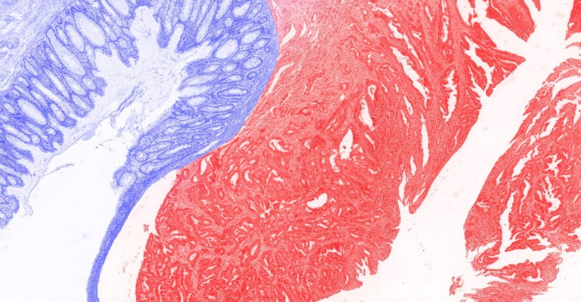 Tissue sample colored in two distinct blue and red segments