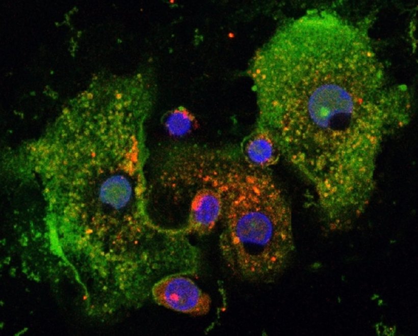 Humane Makrophagen mit immunregulierendem Peptid Pep19-2.5 (grün) und Färbung...