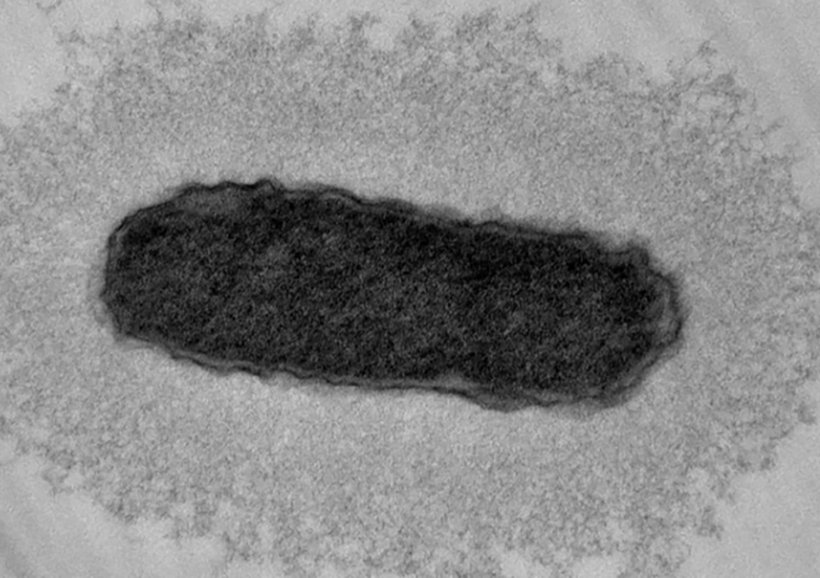Transmissionselektronenmikroskopische Aufnahme von Klebsiella pneumoniae
