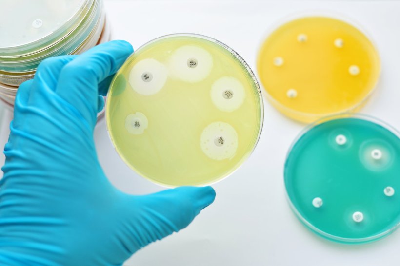 A hand wearing a blue protective rubber glove is holding a petri dish filled...