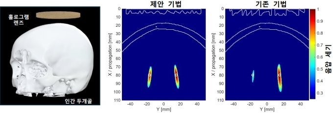Simulation of multi-focal ultrasound stimulation based on a human skull model