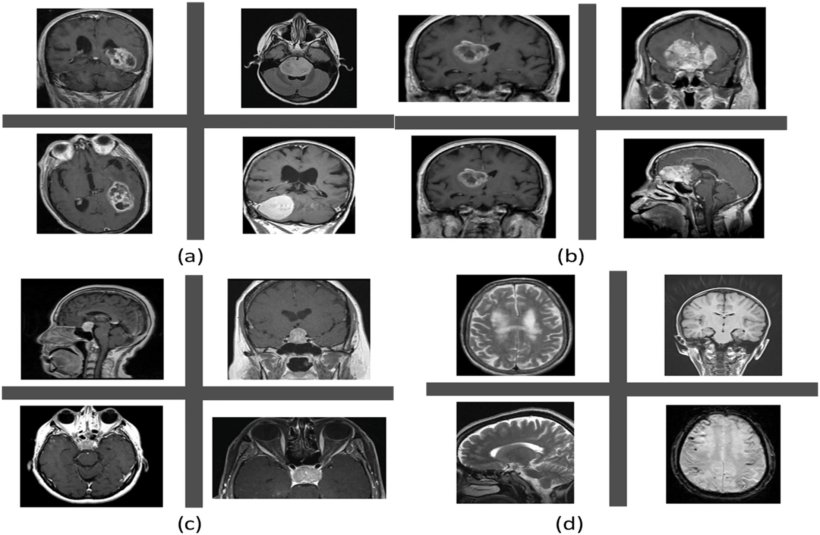 Sixteen MRI scans of human brains, with and without brain tumors, arranged in...