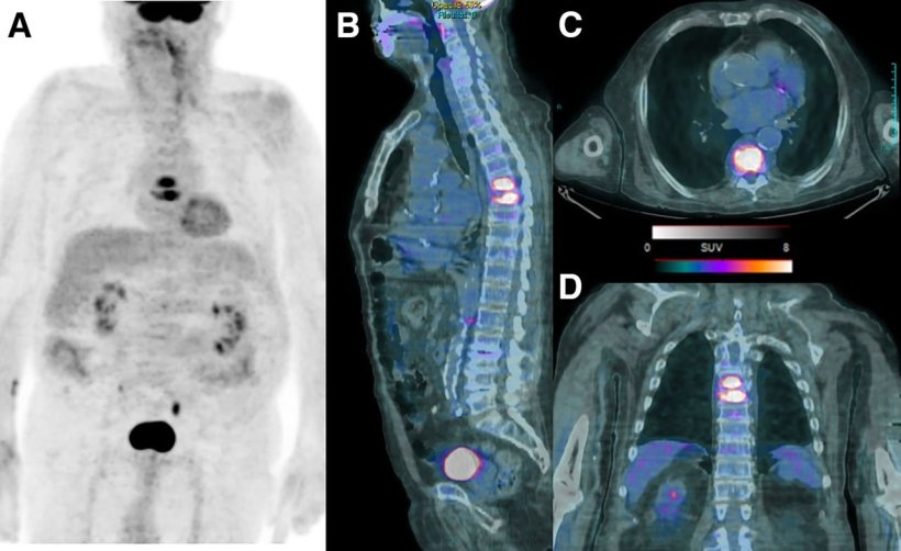 Images from a 59-year-old man admitted to intensive care unit with fever and...