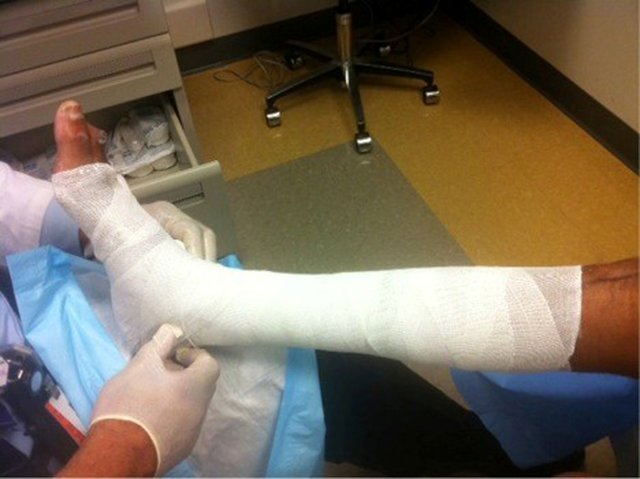A medical professional is applying a compression bandage to a patients leg