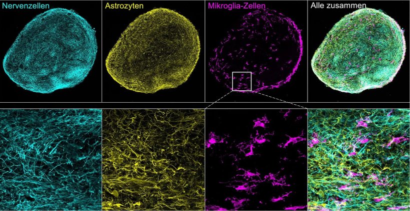 Mikroskopische Ansicht eines 3D Hirngewebemodells, in dem die verschiedenen...