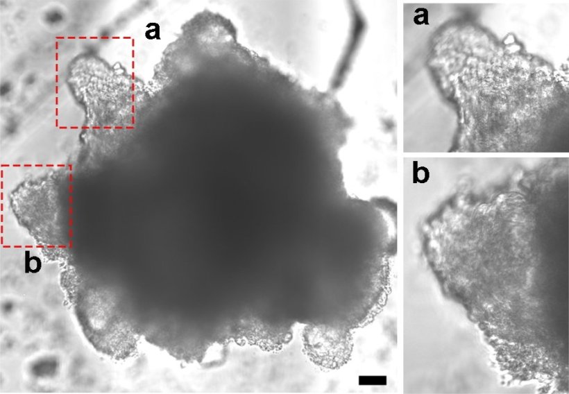 Bright field image showing induced valve-like structure on the assembloid...