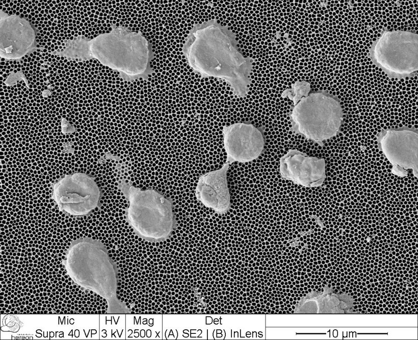 Aufnahme mit einem Elektronenmikroskop von T-Zellen auf einer nanoporösen...