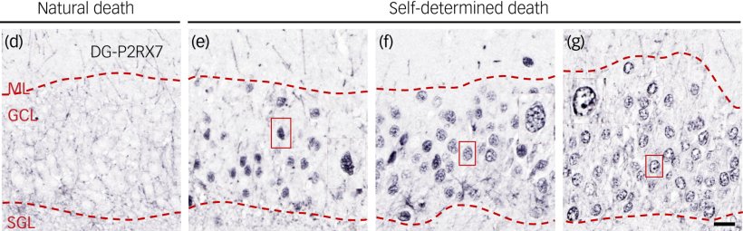 Microscopic images showing P2RX7 expression in the dentate gyrus of individuals...