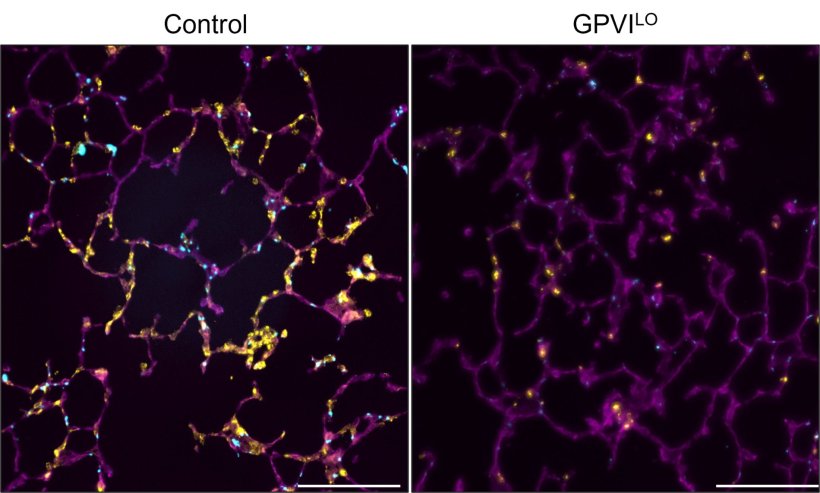 Eine teilweise Verringerung des GPVI-Rezeptors (GPVILO) schützt vor Thrombosen...