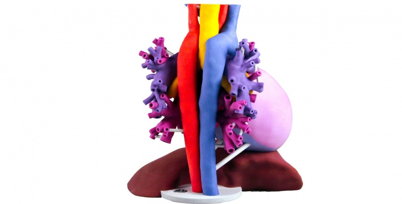 3D Systems’ Patient-specific anatomical model takes 2D medical imaging data...