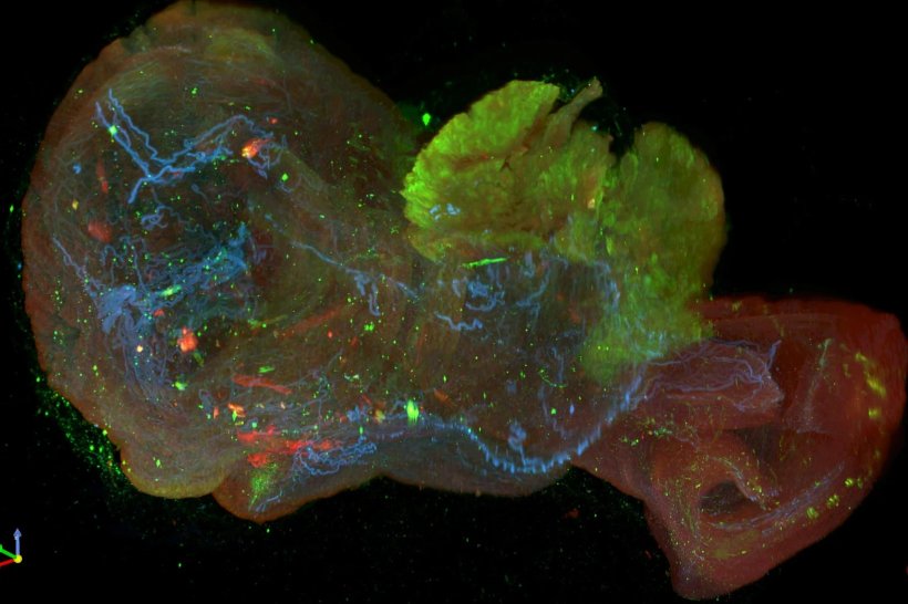 Eine Gewebeprobe in vielen Farben vor einem schwarzen Hintergrund