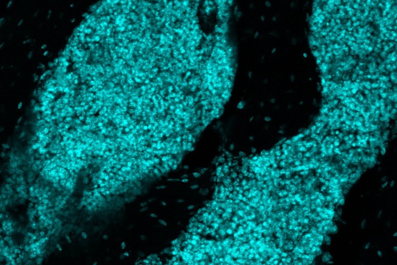 Cyan cell structures against a black background