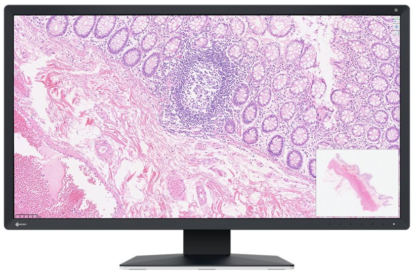 Produktfoto eines Monitors, auf dem eine Gewebeaufnahme aus der Pathologie...