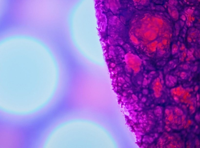 Parkinsons disease: clues in the gut microbiome
