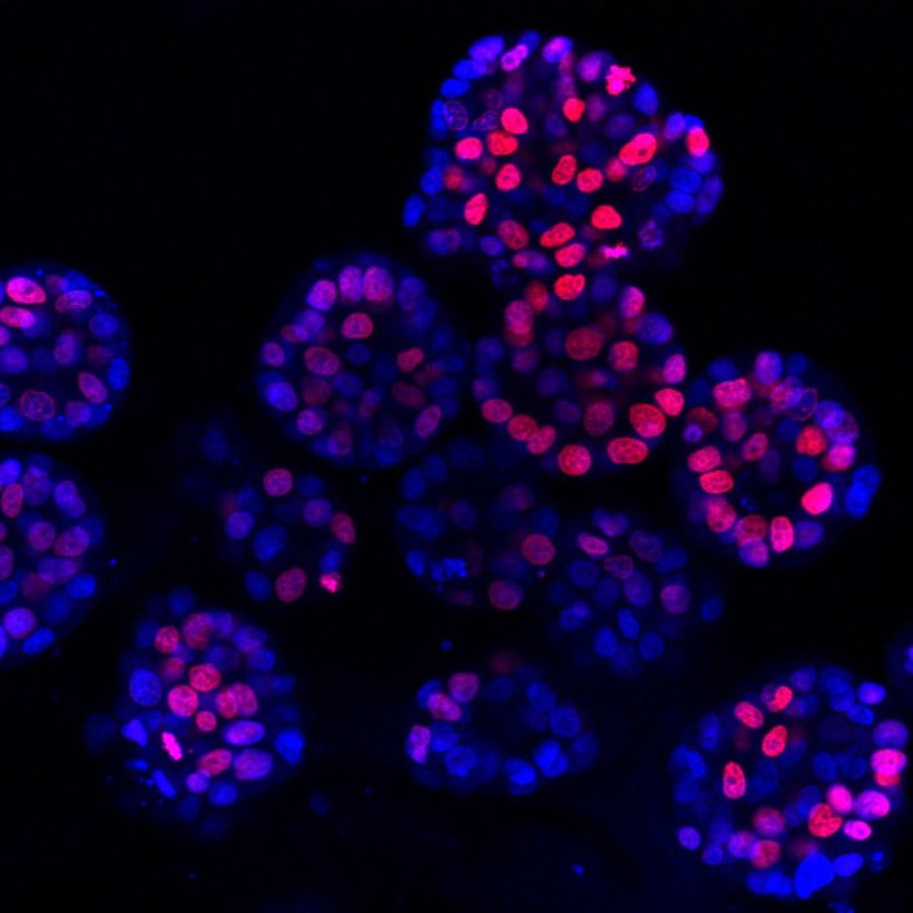 Organoide von Leberkrebs als runde Zellsammlungen in Blau und Rot vor einem...