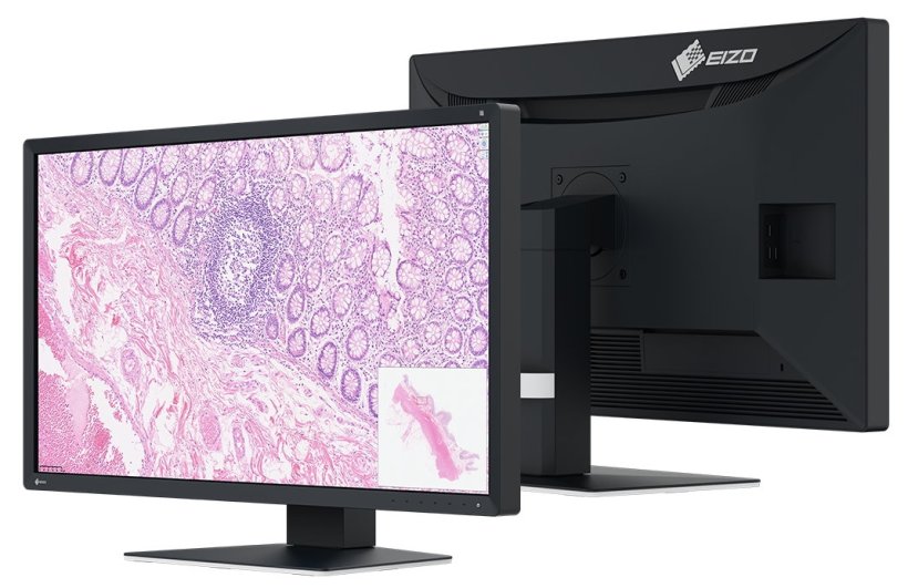 New: EIZO PX3150 for digital pathology