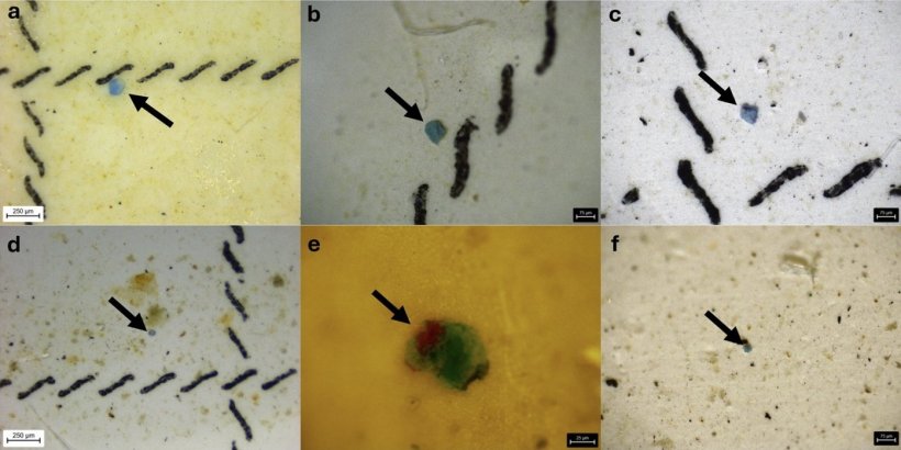 Six pictures of microplastics obtained from lung biopsies