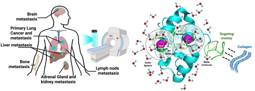 The graphic shows common sites where lung cancer can spread and illustrates how...