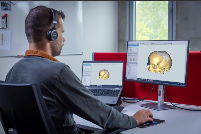 Digital planning in skull reconstruction: from benefit to necessity