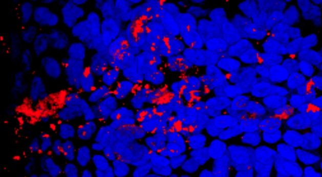 Treatment with peptide mimetics reduced the number of bacteria present on the...