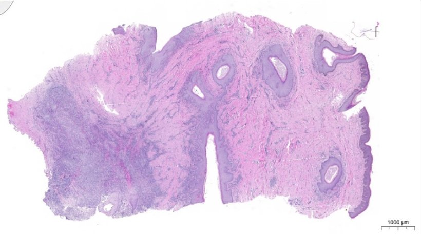 Histologische Untersuchtung von erkranktem Gewebe