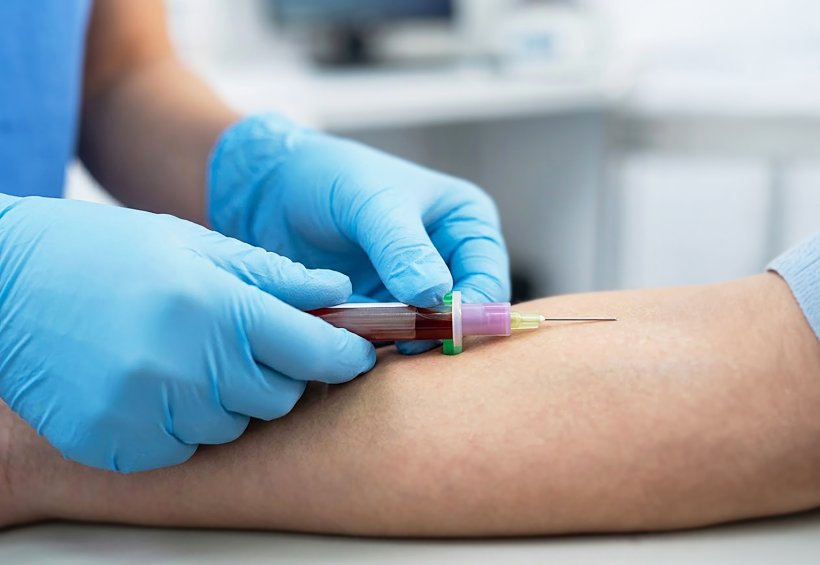 DNA in blood signals cancer risk years ahead