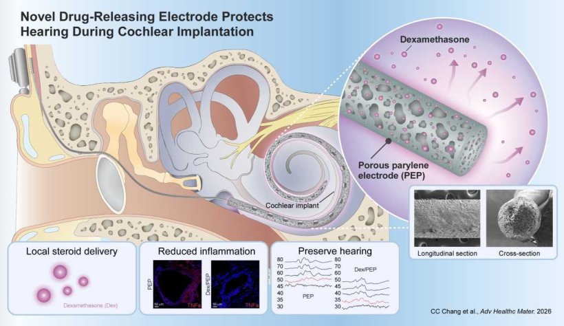 A porous parylene electrode prototype loaded with dexamethasone enters the...